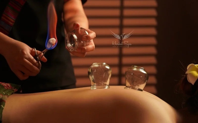 Cupping therapy in traditional Vietnamese massage
