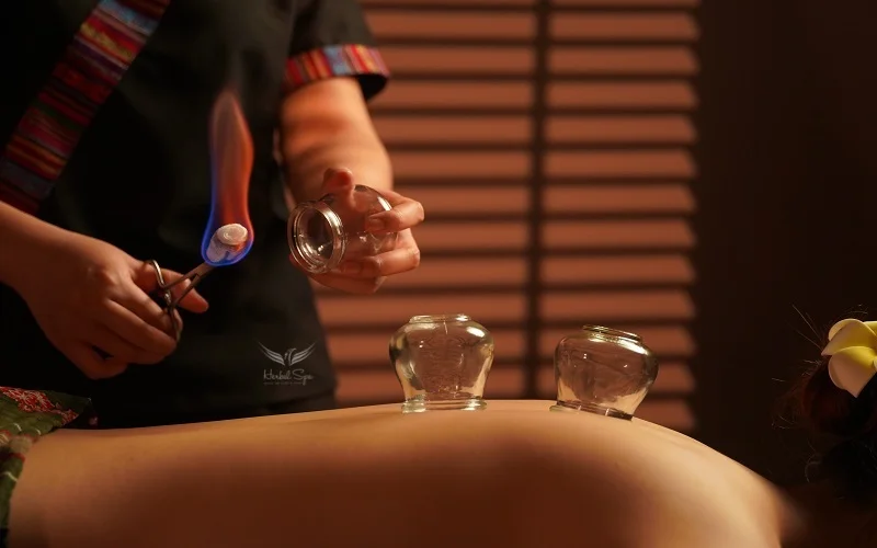 Cupping therapy in traditional Vietnamese massage