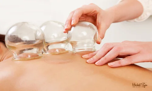 Cupping therapy in Traditional Vietnamese Massage at Herbal Spa