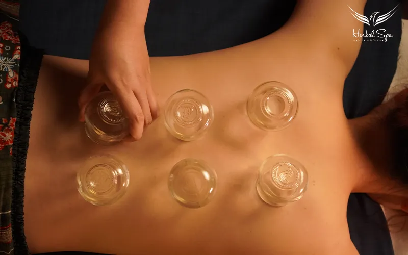 các huyệt giác hơi