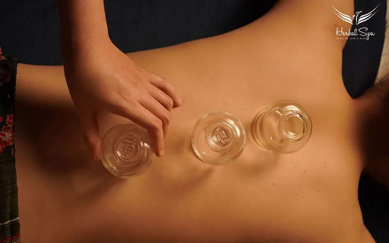 giác hơi huyệt a thị