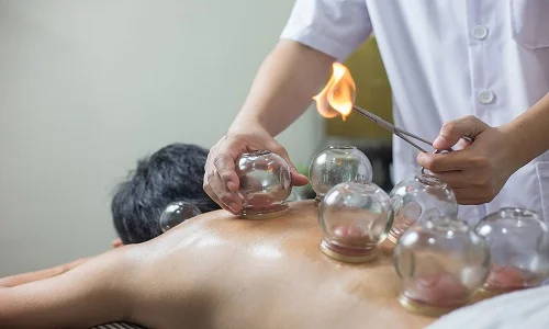 Cupping is a traditional Chinese massage therapy