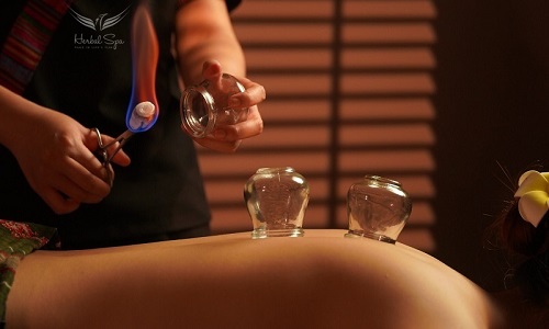 Back Cupping near me