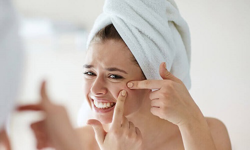 다낭 얼굴 관리: 여드름 피부에 순한 성분으로 케어하는 효과적인 방법.