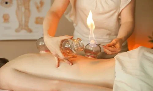 越式背部按摩是越南传统按摩动作与拔罐相结合