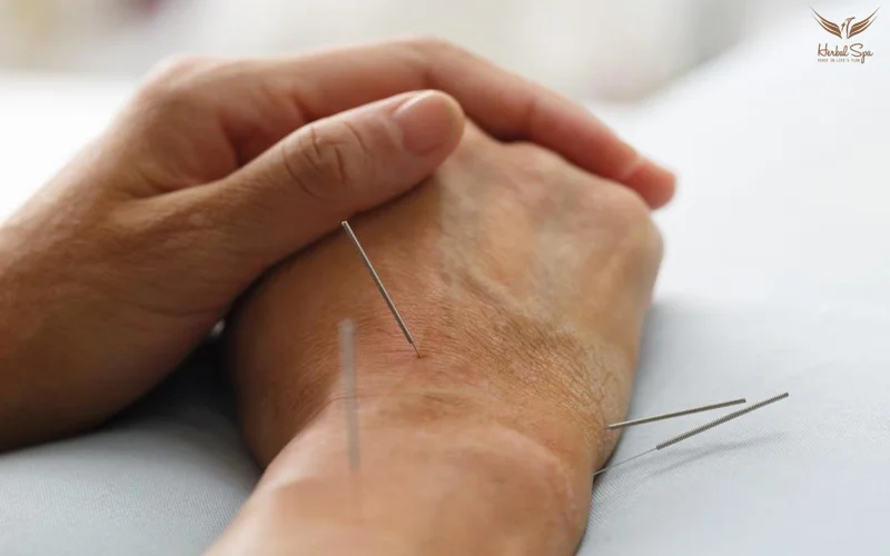 Châm cứu huyệt Dưỡng Lão 