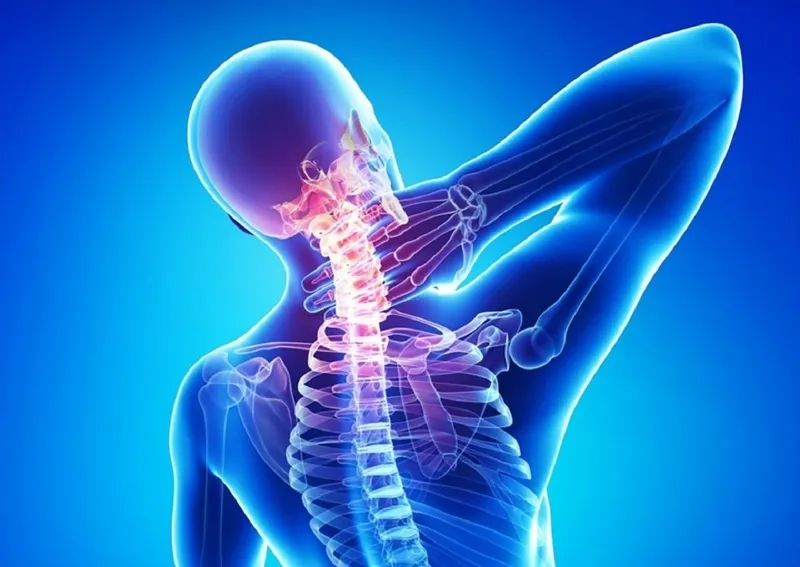 Nguyên nhân gây đau cổ vai gáy