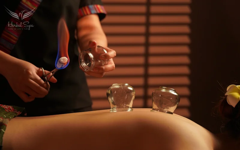 A therapist places cups on the skin to create suction