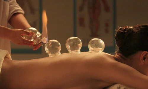 Phương pháp giác hơi trong dịch vụ Massage lưng tại Herbal Spa Đà Nẵng