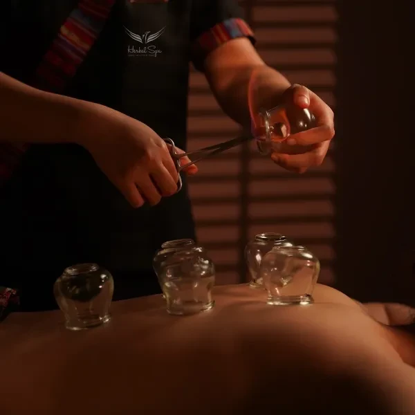 허벌 부항 요법